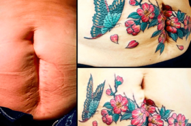 Ukrywają blizny po cesarskim cięciu robiąc sobie tatuaże - czy to już nowa moda?