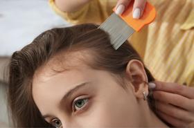 Dziecko ma wszy: jak długo musi zostać w domu? Wyjaśniamy