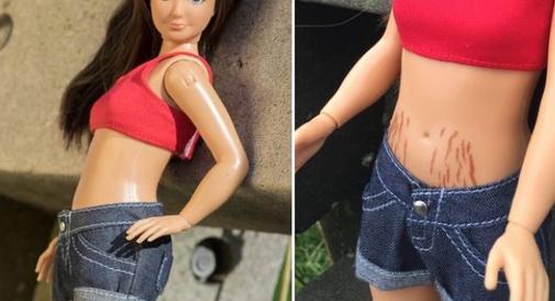 Barbie ma rozstępy! Koniec ze stereotypem "idealnej kobiety", który... nie istnieje.