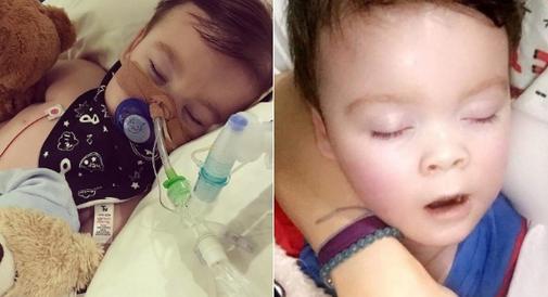 Tragicznie zmarły ALFIE Evans ma BRACISZKA. Czy mały Tom także będzie CHORY?