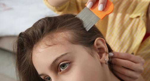 Dziecko ma wszy: jak długo musi zostać w domu? Wyjaśniamy