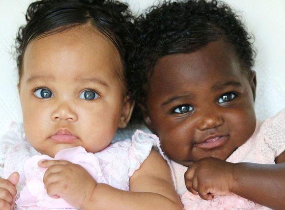 Bliźniaczki o różnych odcieniach skóry zostały gwiazdami Instagrama. Jak to możliwe, że tak bardzo się różnią?
