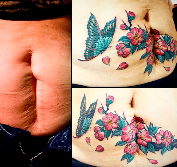 Ukrywają blizny po cesarskim cięciu robiąc sobie tatuaże - czy to już nowa moda?