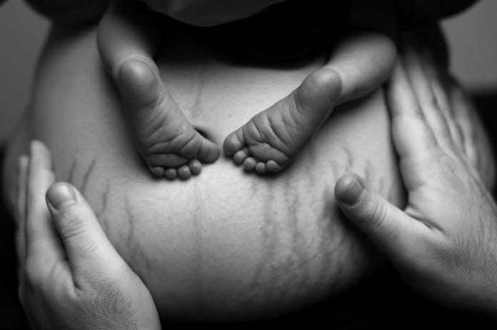 Postanowiła pokazać niefiltrowaną stronę ciąży - pomaga kobietom pokochać swoje ciało po porodzie