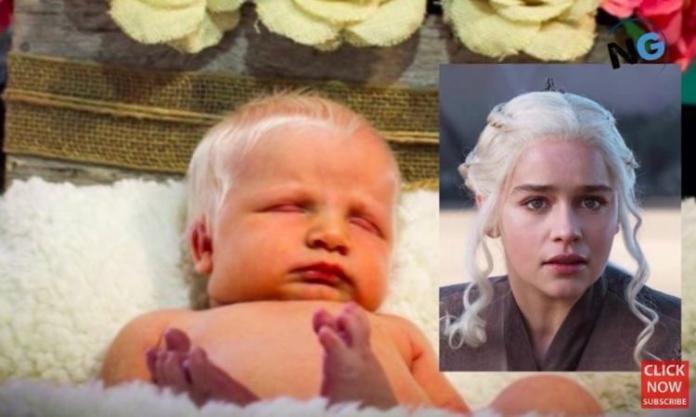 Ta dziewczynka ma lśniące białe włosy jak Emilia Clarke z "Gry o tron", a jej mama musi się tłumaczyć, że nie edytuje zdjęć w Photoshopie!