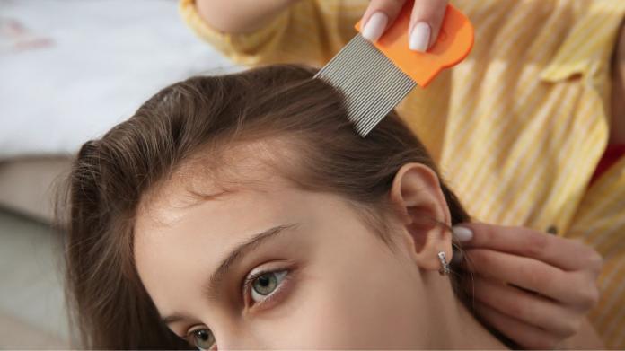 Dziecko ma wszy: jak długo musi zostać w domu? Wyjaśniamy
