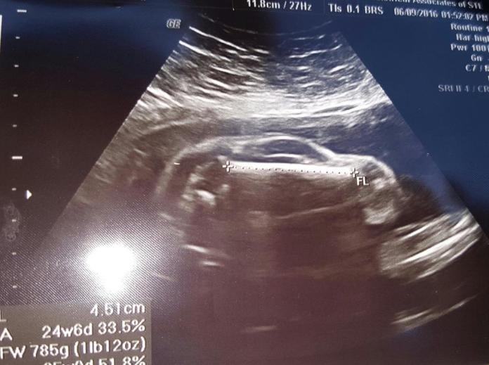 "Moja żona jest w ciąży z..."- ojciec dzieli się zdjęciem USG, które zszokowało wszystkich