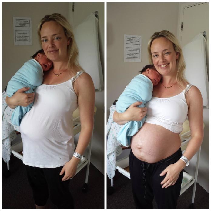 Po porodzie, fotografowała swój brzuch przez 14 tygodni, odkrywając brutalną prawdę o ciąży...