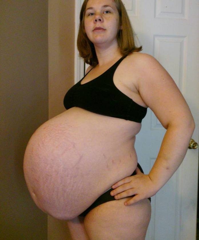 Nie wszystkie ciąże wyglądają jak te z okładek gazet... Te kobiety pokazują bolesną prawdę. [ZDJĘCIA NIE DLA WRAŻLIWYCH]