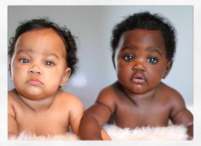 Bliźniaczki o różnych odcieniach skóry zostały gwiazdami Instagrama. Jak to możliwe, że tak bardzo się różnią?