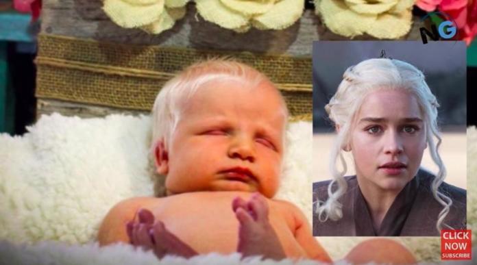 Ta dziewczynka ma lśniące białe włosy jak Emilia Clarke z "Gry o tron", a jej mama musi się tłumaczyć, że nie edytuje zdjęć w Photoshopie!